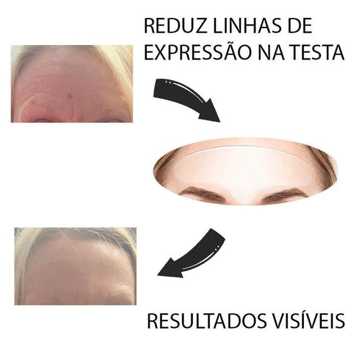 Kit Auralift Clean© - Adesivos Anti-Rugas das famosas (Reutilizável)